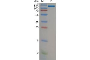 Human CFB Protein, hFc Tag on SDS-PAGE under reducing condition.