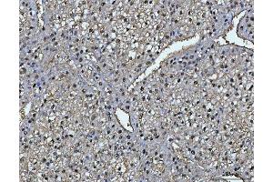 IHC analysis of FAA/FAH using anti-FAA/FAH antibody (ABIN7599291). (FAH anticorps  (AA 1-342))