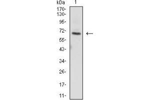 Western blot analysis using ZAP70 mouse mAb against MLOT4 (1) cell lysate.