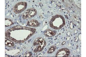 Image no. 5 for anti-Copper Metabolism (Murr1) Domain Containing 1 (COMMD1) antibody (ABIN1497563)