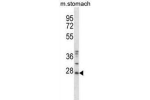 Western Blotting (WB) image for anti-TP53 Regulating Kinase (TP53RK) antibody (ABIN2997879) (TP53RK anticorps)