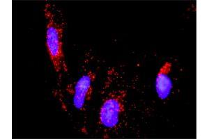 Proximity Ligation Analysis of protein-protein interactions between PTK2B and ERBB2.