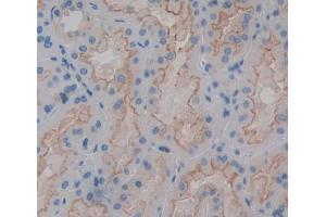 Used in DAB staining on fromalin fixed paraffin- embedded kidney tissue