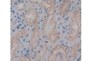 Used in DAB staining on fromalin fixed paraffin- embedded kidney tissue (ABCD4 anticorps  (AA 356-606))