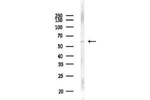 Western blot analysis of lysates from Mouse lung, using Cytokeratin 5 Antibody at 1/1000 dilution.