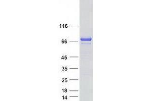 Validation with Western Blot