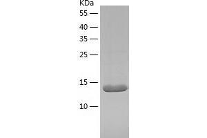 Western Blotting (WB) image for Myoglobin (MB) (AA 2-154) protein (His-IF2DI Tag) (ABIN7124053)