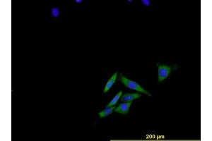 Immunofluorescence of monoclonal antibody to ENG on HeLa cell .