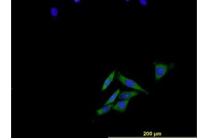 Immunofluorescence of monoclonal antibody to ENG on HeLa cell . (Endoglin anticorps  (AA 27-658))