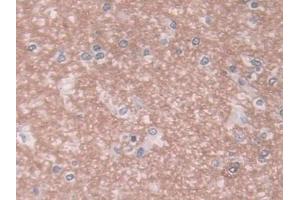 DAB staining on IHC-P; Samples: Human Cerebrum Tissue (SEMG1 anticorps  (AA 24-462))