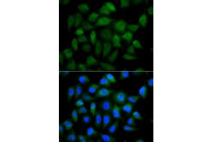 Immunofluorescence analysis of HeLa cells using AFP antibody (ABIN5970034). (alpha Fetoprotein anticorps  (C-Term))