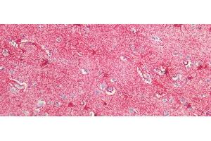 Detection of GFAP in Human Cortex Tissue using Polyclonal Antibody to Glial Fibrillary Acidic Protein (GFAP)