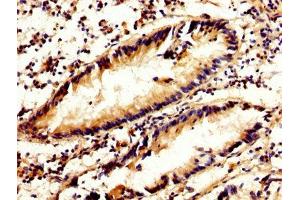 IHC image of ABIN7146540 diluted at 1:300 and staining in paraffin-embedded human appendix tissue performed on a Leica BondTM system.