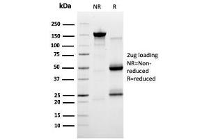 SDS-PAGE Analysis Purified PAI-RBP1 Mouse Monoclonal Antibody (SERBP1/3491).