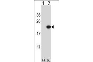 Western blot analysis of EDN2 (arrow) using rabbit polyclonal EDN2 Antibody (C-term) (ABIN657784 and ABIN2846758). (Endothelin 2 anticorps  (C-Term))