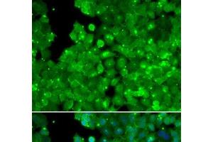 Immunofluorescence analysis of U2OS cells using IL10RA Polyclonal Antibody (IL-10RA anticorps)