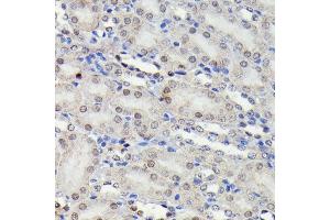 Immunohistochemistry of paraffin-embedded mouse kidney using Phospho-JNK1/2/3-T183/T183/T221 antibody (ABIN6135251, ABIN6135990, ABIN6135991 and ABIN7101879) at dilution of 1:100 (40x lens). (MAPK8/9/10 anticorps  (pThr183, pThr221, Thr183))