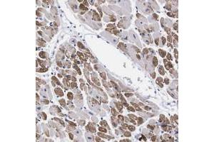 Immunohistochemical staining of human heart muscle with NEBL polyclonal antibody  shows strong cytoplasmic positivity in myocytes at 1:50-1:200 dilution. (Nebulette anticorps)