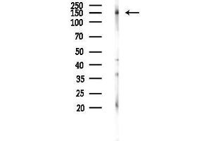 Western blot analysis of lysates from Rat brain, using Phospho-EGFR (Tyr1086)[Tyr1110] Antibody at 1/1000 dilution.