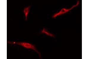 ABIN6274765 staining HeLa cells by IF/ICC.