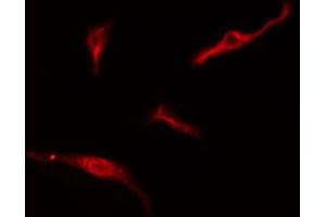 ABIN6274765 staining HeLa cells by IF/ICC. (RPL10A anticorps  (C-Term))