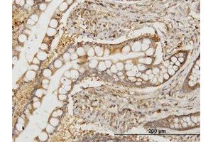 Image no. 1 for anti-N-Myc (And STAT) Interactor (NMI) (AA 1-101) antibody (ABIN598596) (NMI anticorps  (AA 1-101))