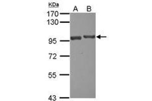 Image no. 1 for anti-USP6 N-terminal Like (USP6NL) (N-Term) antibody (ABIN1494111) (USP6NL anticorps  (N-Term))