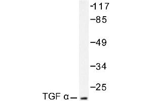 Image no. 1 for anti-Transforming Growth Factor, alpha (TGFA) antibody (ABIN271847) (TGFA anticorps)