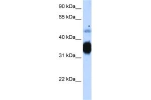 WB Suggested Anti-TNNT3 Antibody Titration:  1.