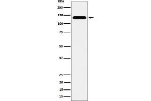 Western blot analysis of CYFIP1 expression in HeLa cell lysate.