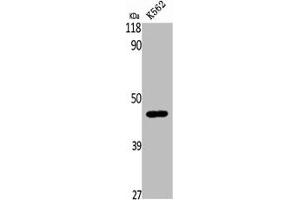 Western Blot analysis of K562 cells using β-1,4-Gal-T5 Polyclonal Antibody