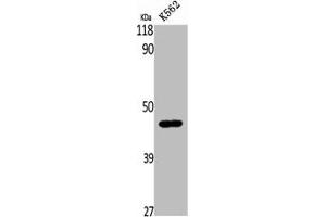 Western Blot analysis of K562 cells using β-1,4-Gal-T5 Polyclonal Antibody (B4GALT5 anticorps  (C-Term))