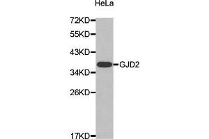 Western Blotting (WB) image for anti-Gap Junction Protein, delta 2, 36kDa (GJD2) (AA 99-197) antibody (ABIN3016909) (GJD2 anticorps  (AA 99-197))