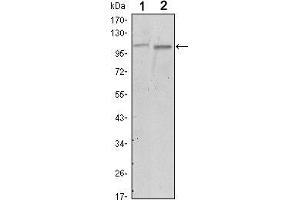 Western blot analysis using FAK mouse mAb against A549 (1) and NIH/3T3 (2) cell lysate.