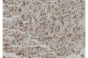 ABIN6272261 at 1/100 staining Human lung tissue by IHC-P.