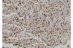 ABIN6272261 at 1/100 staining Human lung tissue by IHC-P. (CEBPZ anticorps  (N-Term))