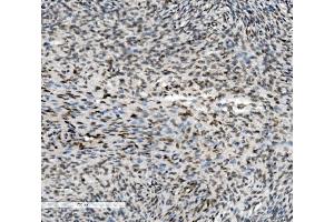 IHC analysis of METTL1 using anti-METTL1 antibody (ABIN7600484).