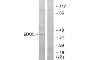 Western blot analysis of extracts from COLO205 cells, using EDG5 Antibody. (S1PR2 anticorps  (AA 261-310))