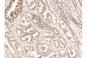 ABIN334520 (8µg/ml) staining of paraffin embedded Human Prostate. (TUSC3 anticorps  (Internal Region))