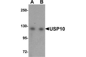 Western blot analysis of USP10 in Jurkat cell lysate with USP10 antibody at (A) 1 and (B) 2 μg/ml. (USP10 anticorps  (N-Term))