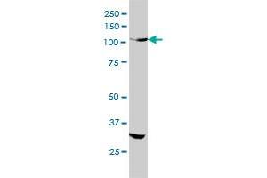 INSRR monoclonal antibody (M01), clone 6E6 Western Blot analysis of INSRR expression in HeLa .