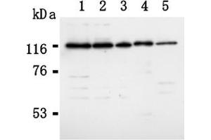 Western Blotting (WB) image for anti-RAD21 Homolog (RAD21) (AA 544-631), (C-Term) antibody (ABIN567792) (RAD21 anticorps  (C-Term))