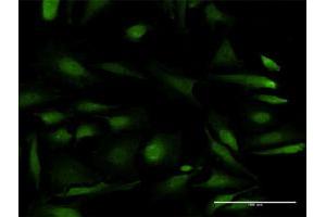 Immunofluorescence of purified MaxPab antibody to RPS6KB2 on HeLa cell. (RPS6KB2 anticorps  (AA 1-482))