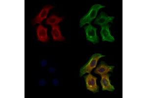 ABIN6264149 and ABIN6273012 staining Hela cells by IF/ICC. (PEX16 anticorps  (Internal Region))