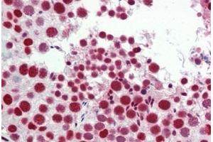 Human Testis: Formalin-Fixed, Paraffin-Embedded (FFPE)