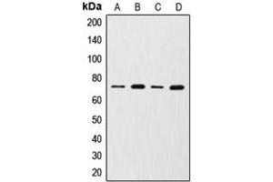 Western blot analysis of MMP2 expression in HuvEc (A), NRK (B), MCF7 (C), HT1080 (D) whole cell lysates.