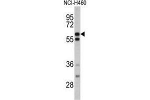 Western blot analysis of GNS antibody (Center S298) in NCI-H460 cell line lysates (35 µg/lane). (GNS anticorps  (Middle Region))