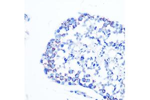 Immunohistochemistry of paraffin-embedded mouse testis using Monoamine Oxidase B (MAOB) (MAOB) Rabbit mAb (ABIN7268682) at dilution of 1:100 (40x lens).