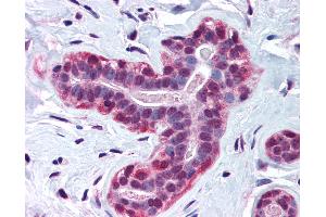 Anti-WRNIP1 / WHIP antibody IHC of human breast. (WRNIP1 anticorps  (AA 67-116))