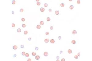 Immunohistochemistry (IHC) image for anti-Pappalysin 2 (PAPPA2) (N-Term) antibody (ABIN1031518) (PAPPA2 anticorps  (N-Term))